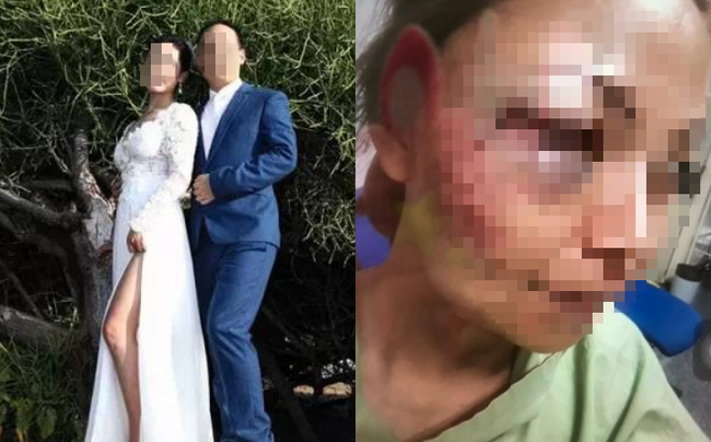 Chồng đánh vợ vì bị lộ chuyện ngoại tình, cận Tết nhưng cô vợ vẫn đưa ra quyết định cứng được dân tình rào rào ủng hộ-1