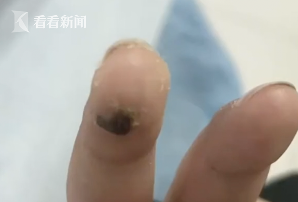 Mẹ dắt con trai đi mua trà sữa, trong lúc xếp hàng ngửi mùi cháy khét mới phát hiện điều kinh khủng đã xảy ra với đứa trẻ của mình-3