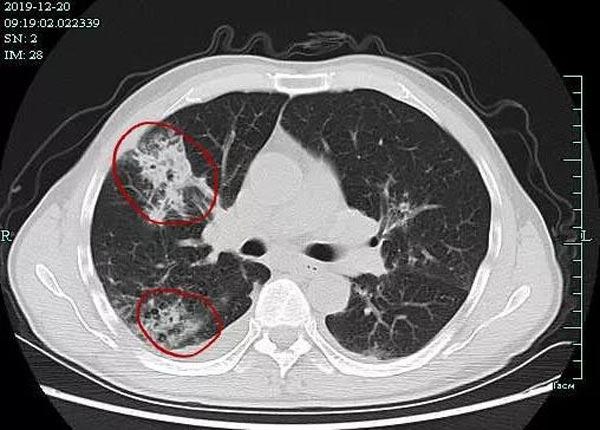 Suýt thiệt mạng vì dọn nhà ngày Tết, sát thủ này có thể ẩn chứa ngay trong nhà-1