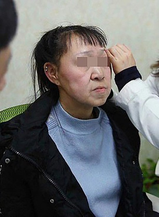 Cô gái 15 tuổi nhưng sở hữu gương mặt như cụ bà nay đã có diện mạo mới khiến ai cũng trầm trồ-2