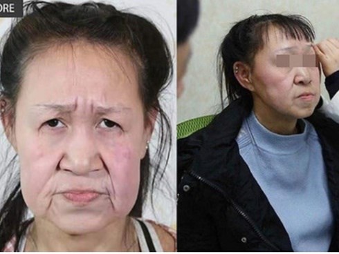 Cô gái 15 tuổi nhưng sở hữu gương mặt như cụ bà nay đã có diện mạo mới khiến ai cũng trầm trồ