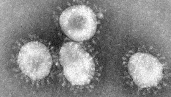 Bệnh viêm phổi do virus Corona gây ra lây lan cách nào và phòng ngừa-1