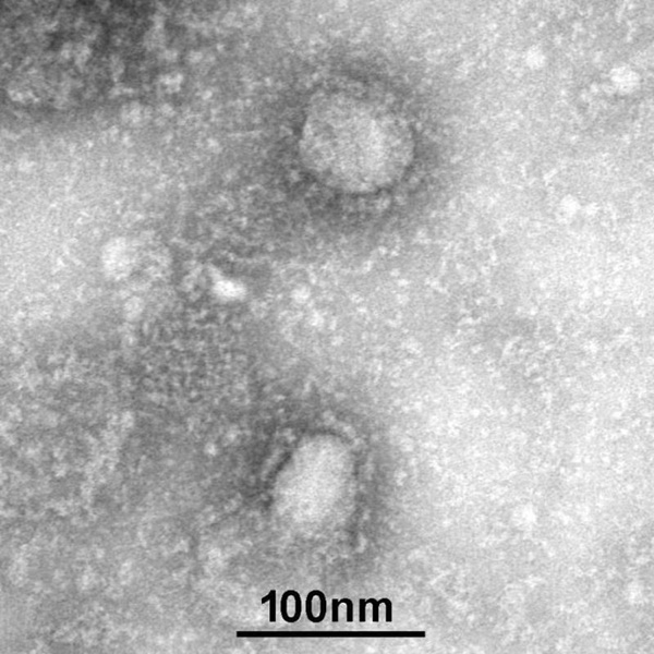 TQ công bố chân dung virus corona: Sự nguy hiểm chết người đằng sau tử thần nhỏ hơn cả bụi siêu mịn-1
