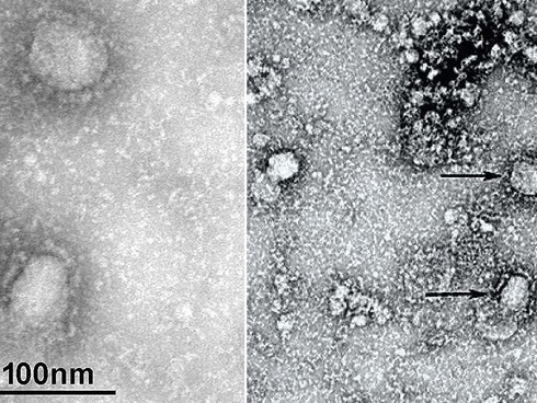 Khách Trung Quốc quậy bệnh viện vì con bị kiểm tra virus corona-2
