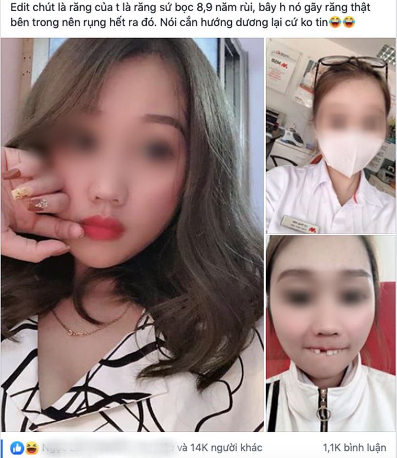 Cắn hướng dương ngày Tết, cô gái trẻ bị... rụng cả răng cửa tốn thêm bạc triệu để làm mới-1