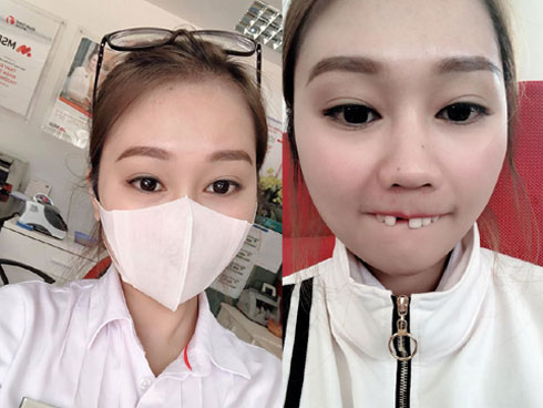 Đang nằm nhà nhai kẹo ôn lại tuổi thơ, cô gái bỗng thấy trong miệng có gió lùa vì rụng một lúc 3 chiếc răng-4