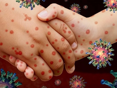 Để phân biệt virus corona và cảm lạnh thông thường, hãy chú ý 1 điều-3