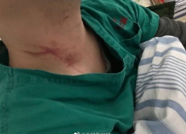 Không cứu sống được bệnh nhân nhiễm virus corona, 2 bác sĩ Vũ Hán bị đánh đập và xé áo bảo hộ cùng tâm sự nhói lòng của một nữ y tá-1
