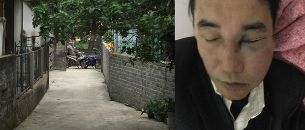 Phản ứng vì quán trà chanh đỗ xe chắn lối đi, nam bác sỹ bị nhiều người đánh nhập viện-1