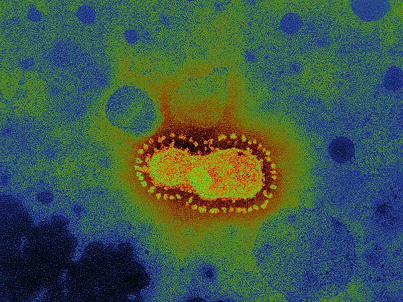 Tin mừng: Tỷ lệ tử vong do virus corona gây ra thấp, hầu hết bệnh nhân đều hồi phục hoàn toàn-4