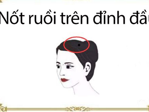3 nốt ruồi trời sinh đào hoa, vệ tinh đuổi không hết-4