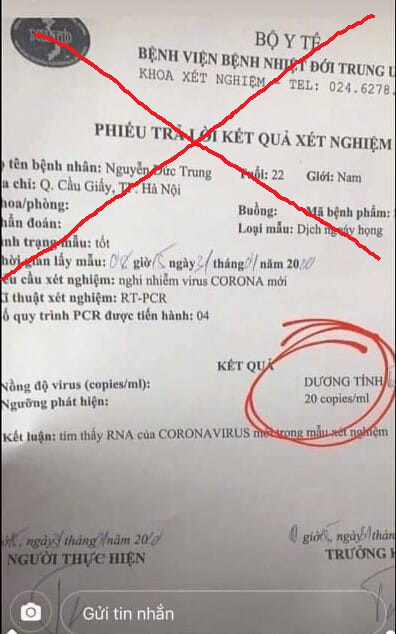 Xuất hiện phiếu xét nghiệm giả có kết quả dương tính virus corona-1