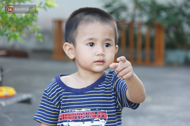 Cuộc sống hiện tại của em bé người đầy vẩy ngứa như da trăn, bị bố mẹ bỏ rơi trong bệnh viện-13