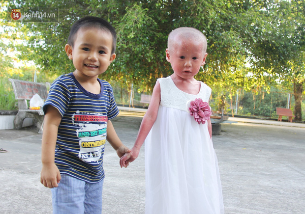 Cuộc sống hiện tại của em bé người đầy vẩy ngứa như da trăn, bị bố mẹ bỏ rơi trong bệnh viện-8