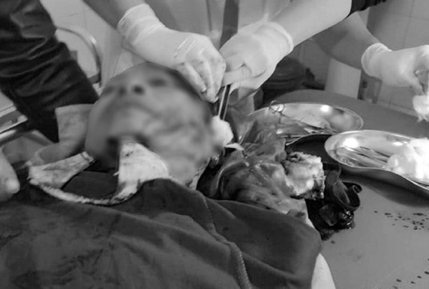 Nghệ An: Công an xã bị hàng chục thanh niên vây chém trong đêm-1