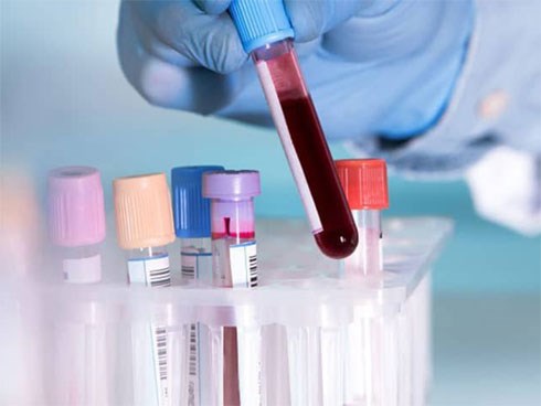 Móng Cái lấy mẫu bệnh phẩm của 1 người tử vong để gửi xét nghiệm virus corona