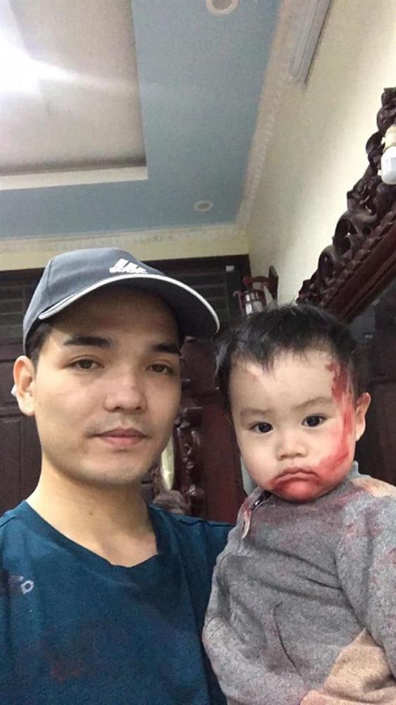 Dở khóc dở cười chuyện trông con mùa dịch virus corona: Lơ là vài phút, ông bố trẻ hốt hoảng thấy con bôi đỏ khắp mặt-3