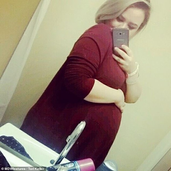 Mang thai 4, bà mẹ phải giữ 3 em bé đã mất trong bụng để đổi lấy sự an toàn cho thai nhi còn lại-1