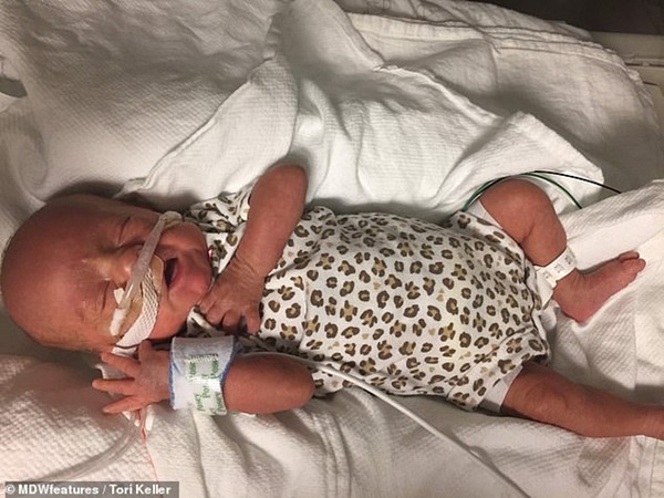 Mang thai 4, bà mẹ phải giữ 3 em bé đã mất trong bụng để đổi lấy sự an toàn cho thai nhi còn lại-4