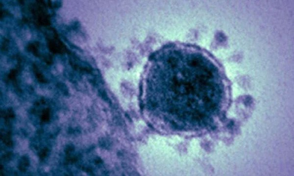 Giải đáp của chuyên gia Harvard: Tại sao các dịch bệnh như virus corona lại giết chết người? Chúng tiến hóa để... tự sát?-2