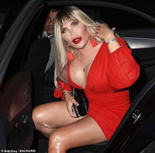 Sau ngoại hình gây sốc của Búp bê Ken đời thực: Bị hiếp dâm từ nhỏ, gần chết vì dao kéo và lý do chuyển giới đáng xót xa-5