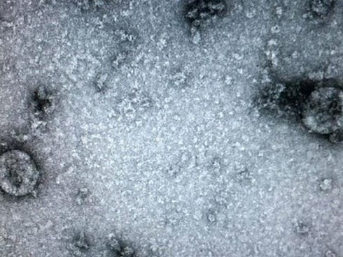 Việt Nam nuôi cấy và phân lập thành công nCoV