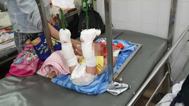 Người cha bạo hành con 4 tháng tuổi xuất huyết não, gãy xương ở Sài Gòn thừa nhận do mâu thuẫn với vợ-1