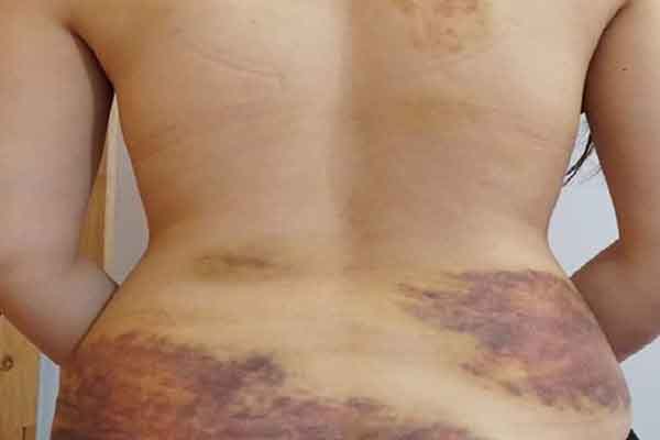 Tiết lộ gây sốc vụ chồng bạo hành vợ ở Tây Ninh, ép quan hệ tình dục: Đánh từ tối hôm trước đến 4h sáng hôm sau-2