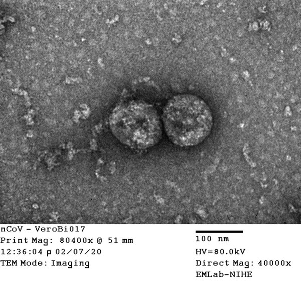 Tin vui đặc biệt từ Việt Nam và bí mật căn phòng đáng sợ nuôi cấy virus Corona-26