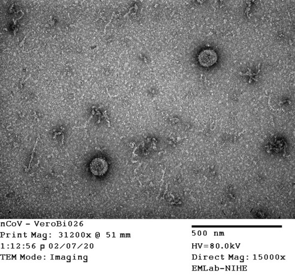 Tin vui đặc biệt từ Việt Nam và bí mật căn phòng đáng sợ nuôi cấy virus Corona-27