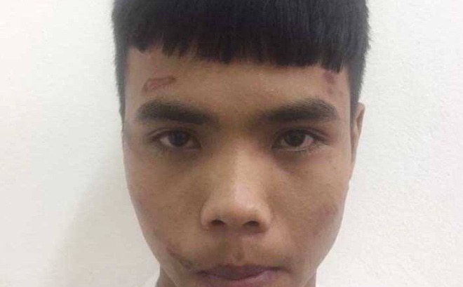 Bị cướp, cô gái trẻ đánh tên cướp trọng thương rồi gọi xe cấp cứu đưa đi viện-1