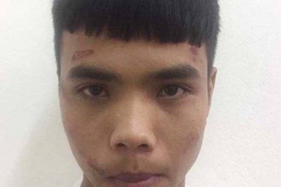 Bị cướp, cô gái trẻ đánh tên cướp trọng thương rồi gọi xe cấp cứu đưa đi viện