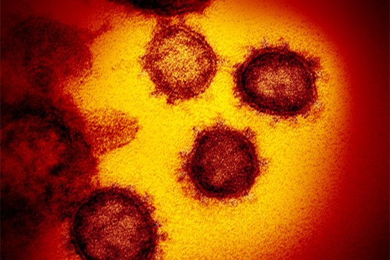 'Bệnh nhân lây cho 6 người ở Vĩnh Phúc có thể nồng độ virus cao'