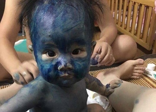 Sự thật về hai loại thuốc xanh, đỏ người mắc thủy đậu hay dùng-1