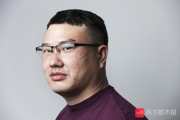 Nỗi lòng y bác sĩ Vũ Hán khi mặc đồ bảo hộ: Nóng bức như tắm hơi, ám ảnh đến muốn nôn nhưng không thể vì sợ phí trang phục-1