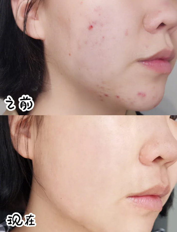 Lịch trình uống nước ấm trong ngày giúp bạn giảm tới 4,5kg chỉ sau 1 tuần-1