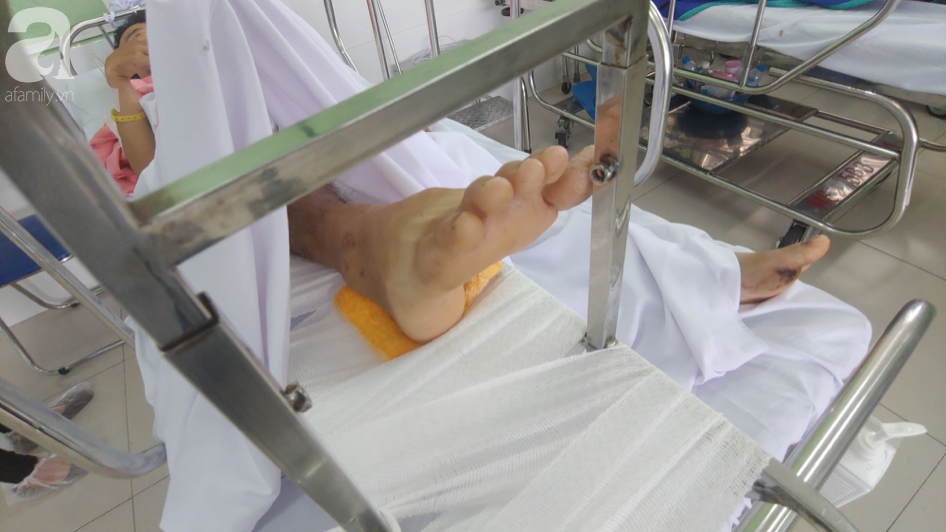 Lời kể nạn nhân vụ 3 người thương vong vì đứt cáp thang máy nhà trọ: Con rể tôi bị cắt cụt tay rồi...-3