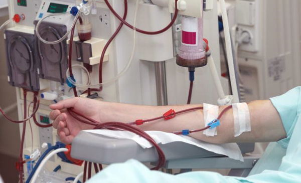 Bác sĩ BV Việt Đức khuyến cáo: Dễ bị hỏng, phải cắt thận vì bỏ qua 5 dấu hiệu cảnh báo sớm-1