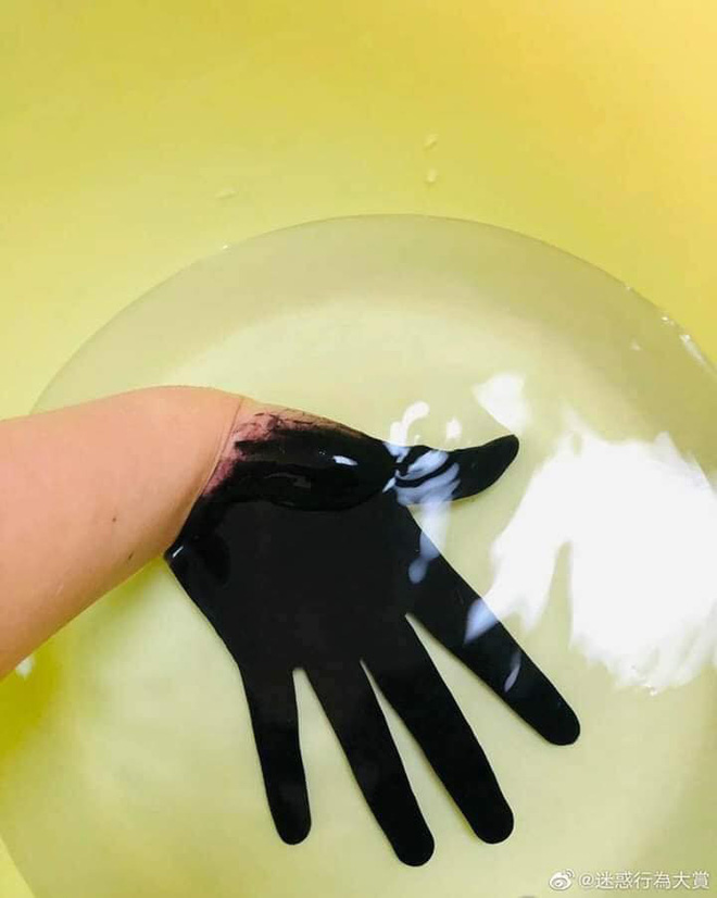 Đôi tay đen phát sợ của người đàn ông, lý do đằng sau khiến ai cũng ngao ngán-1