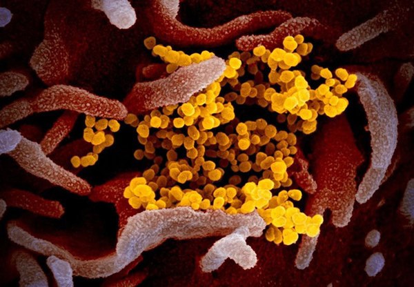 Ngày càng có nhiều ca dương tính Covid-19 trên du thuyền ở Nhật: Virus corona mới liệu có lây lan nhanh hơn khi bị cách ly trong các tàu trên biển?-2
