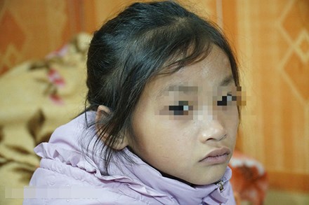 Mẹ tử nạn khi dắt con ăn xin trên cầu Thanh Trì: Bé gái 7 tuổi bây giờ ra sao?