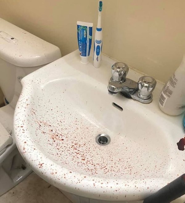Vừa về tới nhà, người đàn ông ngửi thấy mùi hôi thối và nhà tắm đầy máu trước khi cơ quan chức năng phát hiện nguồn cơn từ nhà tầng trên-3