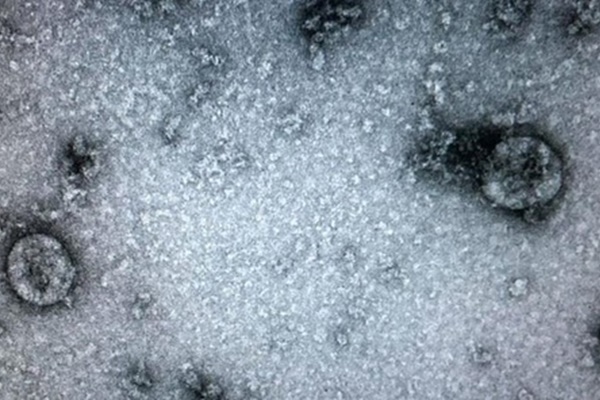 Cuộc sống dân Bắc Kinh giữa dịch virus corona bùng phát-1
