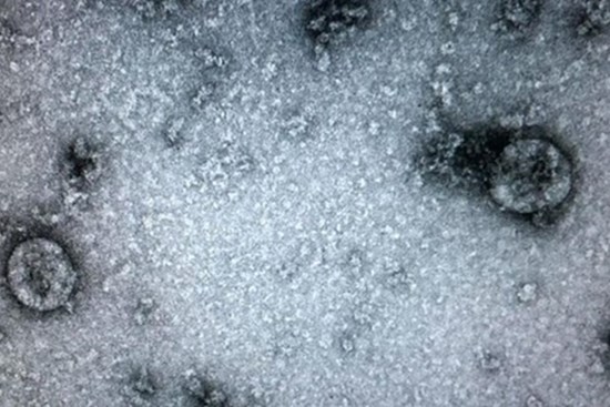Chuyên gia Trung Quốc tiết lộ mới về nguồn gốc lây nhiễm virus corona