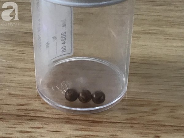 Nuốt món đồ chơi bán tràn lan trên mạng, bé trai 6 tuổi thủng dạ dày suýt chết-2