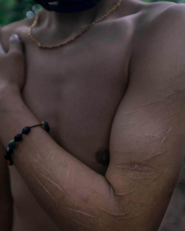 Cám cảnh những thanh niên tị nạn bán dâm sống qua ngày-11