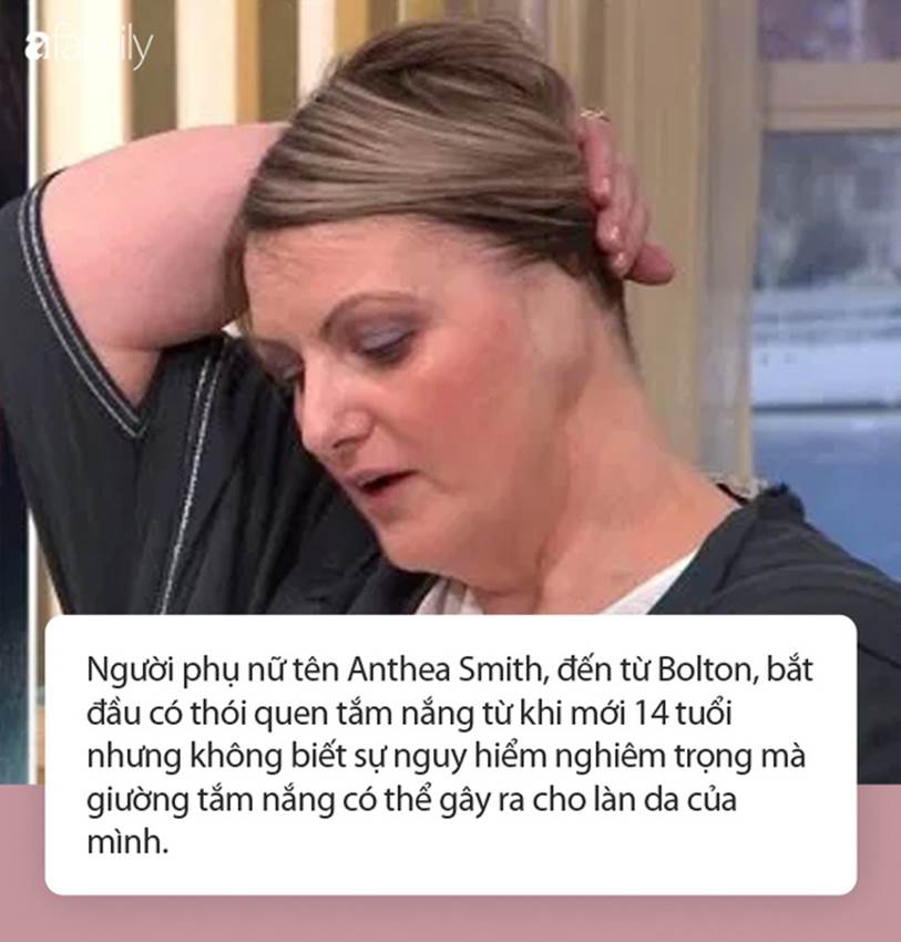 Nằm giường tắm nắng, một phụ nữ phải cắt cụt tai do ung thư da-1