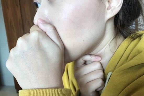 Bác sĩ chuyên sâu về lồng ngực tiết lộ 5 triệu chứng viêm phổi cần điều trị sớm, 3 nhóm người có nguy cơ bị nhiễm bệnh cao nhất