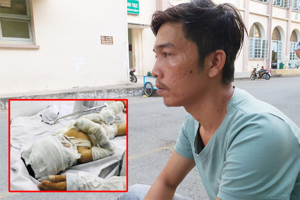 Tình tiết bất ngờ vụ dì tẩm xăng đốt cháu ruột vì món nợ 3 triệu đồng: Bà ngoại biến mất” cùng 200 triệu đồng tiền ủng hộ?-8