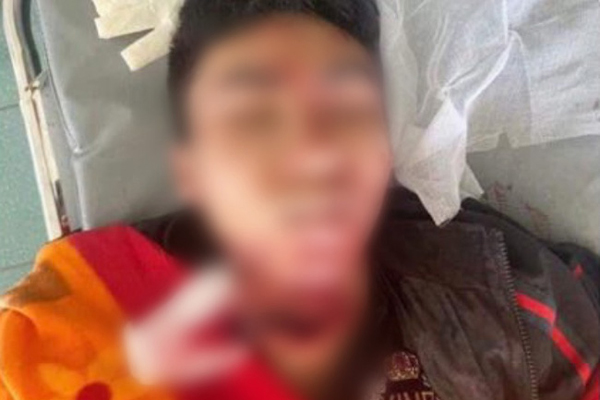 Vợ vắng nhà, yêu râu xanh hiếp dâm con riêng 11 tuổi của vợ-2